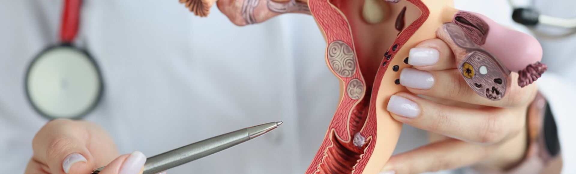 Profissional de saúde segurando modelo seccional de útero e demais estruturas do sistema reprodutor feminino