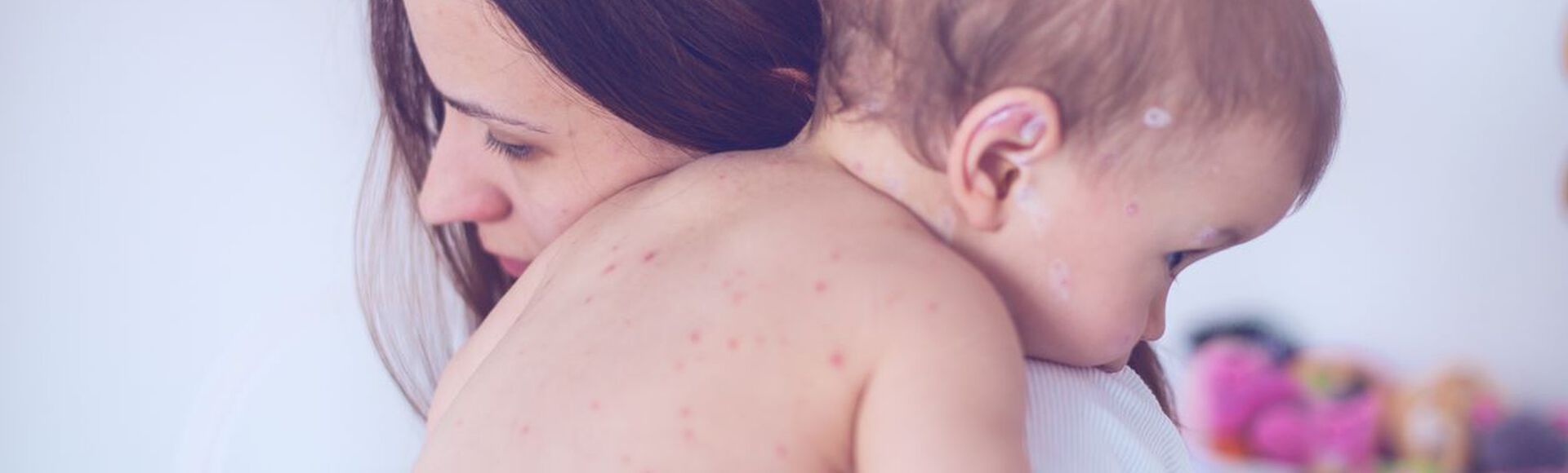 Mãe abraçando bebê com manchas no corpo