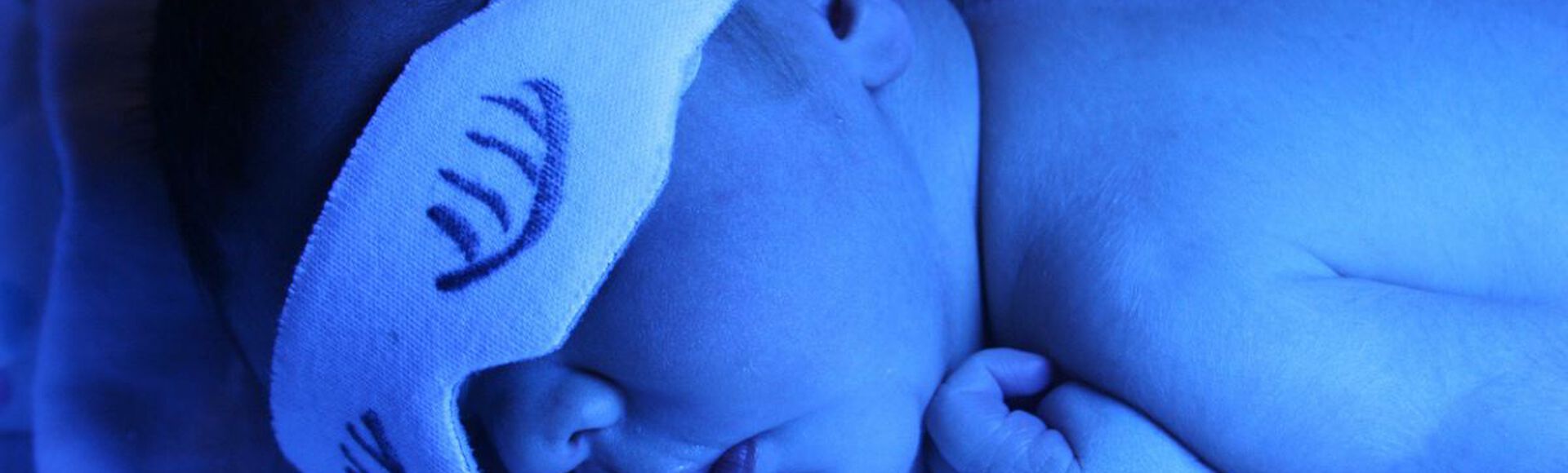 Bebe deitado de bruços com tapa-olho recebendo fototerapia com luz azulada
